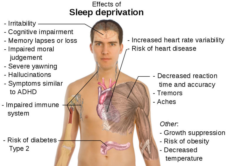 sleepdeprivation